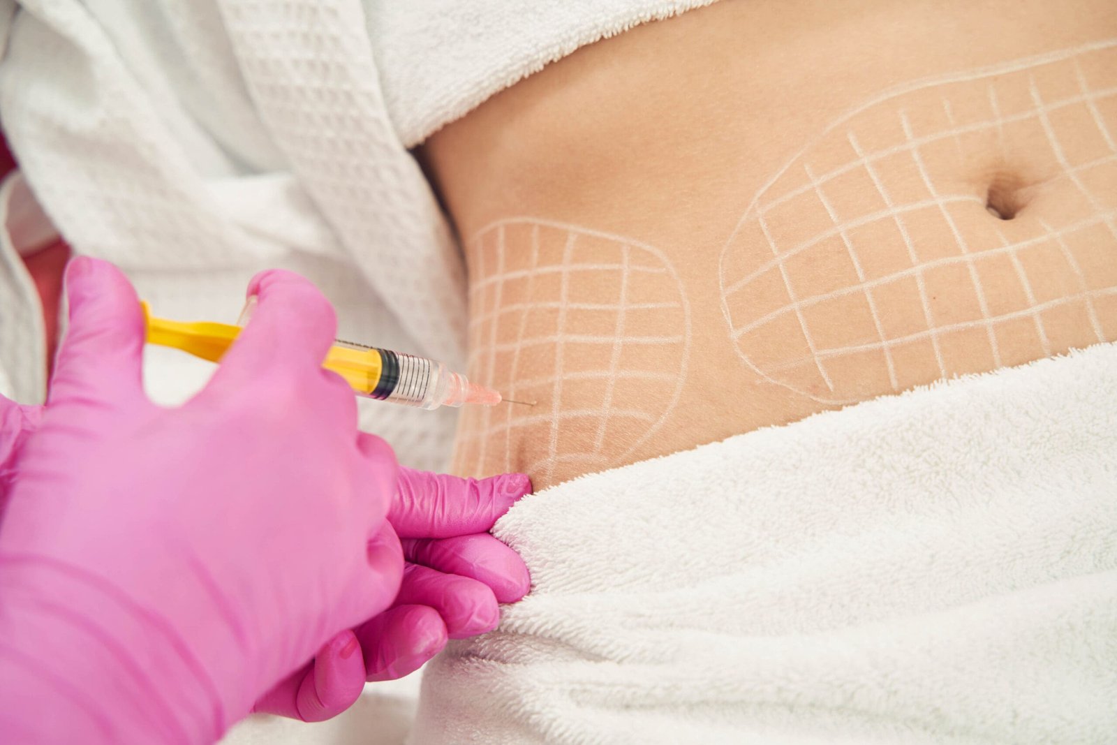 Dermatologist performing non invasive fat reduction procedure in beauty center; Shutterstock ID 2161411819; other: -; purchase_order: -; client: -; job: -